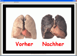 Zigarettenschachtel-Spruch Raucherlunge 